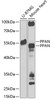 Western blot analysis of extracts of various cell lines, using PPAN Antibody (22-900) at 1:1000 dilution.<br/>Secondary antibody: HRP Goat Anti-Rabbit IgG (H+L) at 1:10000 dilution.<br/>Lysates/proteins: 25ug per lane.<br/>Blocking buffer: 3% nonfat dry milk in TBST.<br/>Detection: ECL Enhanced Kit.<br/>Exposure time: 90s.