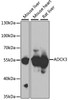 Western blot analysis of extracts of various cell lines, using ADCK3 antibody (22-901) at 1:1000 dilution.<br/>Secondary antibody: HRP Goat Anti-Rabbit IgG (H+L) at 1:10000 dilution.<br/>Lysates/proteins: 25ug per lane.<br/>Blocking buffer: 3% nonfat dry milk in TBST.<br/>Detection: ECL Basic Kit.<br/>Exposure time: 30s.