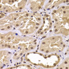 Immunohistochemistry of paraffin-embedded human kidney using CSRP2BP antibody (22-903) at dilution of 1:100 (40x lens) .