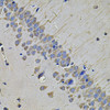 Immunohistochemistry of paraffin-embedded rat brain using NAA50 Antibody (22-907) at dilution of 1:100 (40x lens) .
