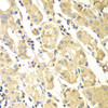 Immunohistochemistry of paraffin-embedded human gastric using PDCD2L antibody (22-911) at dilution of 1:100 (40x lens) .