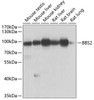 Western blot analysis of extracts of various cell lines, using BBS2 antibody (22-928) at 1:1000 dilution.<br/>Secondary antibody: HRP Goat Anti-Rabbit IgG (H+L) at 1:10000 dilution.<br/>Lysates/proteins: 25ug per lane.<br/>Blocking buffer: 3% nonfat dry milk in TBST.<br/>Detection: ECL Enhanced Kit.<br/>Exposure time: 5s.