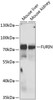 Western blot analysis of extracts of various cell lines, using FURIN antibody (22-945) at 1:1000 dilution._Secondary antibody: HRP Goat Anti-Rabbit IgG (H+L) at 1:10000 dilution._Lysates/proteins: 25ug per lane._Blocking buffer: 3% nonfat dry milk in TBST._Detection: ECL Enhanced Kit._Exposure time: 5s.