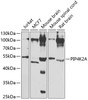Western blot analysis of extracts of various cell lines, using PIP4K2A antibody (22-946) at 1:1000 dilution._Secondary antibody: HRP Goat Anti-Rabbit IgG (H+L) at 1:10000 dilution._Lysates/proteins: 25ug per lane._Blocking buffer: 3% nonfat dry milk in TBST._Detection: ECL Enhanced Kit._Exposure time: 90s.