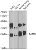 Western blot analysis of extracts of various cell lines, using RAB5B antibody (22-947) at 1:1000 dilution._Secondary antibody: HRP Goat Anti-Rabbit IgG (H+L) at 1:10000 dilution._Lysates/proteins: 25ug per lane._Blocking buffer: 3% nonfat dry milk in TBST._Detection: ECL Enhanced Kit._Exposure time: 90s.