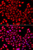 Immunofluorescence analysis of A549 cells using RARG antibody (22-948) . Blue: DAPI for nuclear staining.