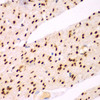 Immunohistochemistry of paraffin-embedded human colon using TEAD3 antibody (22-951) at dilution of 1:100 (40x lens) .