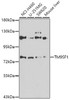 Western blot analysis of extracts of various cell lines, using TM9SF1 antibody (22-957) at 1:1000 dilution.<br/>Secondary antibody: HRP Goat Anti-Rabbit IgG (H+L) at 1:10000 dilution.<br/>Lysates/proteins: 25ug per lane.<br/>Blocking buffer: 3% nonfat dry milk in TBST.<br/>Detection: ECL Enhanced Kit.<br/>Exposure time: 30s.