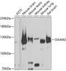 Western blot analysis of extracts of various cell lines, using DAAM2 antibody (22-959) at 1:1000 dilution.<br/>Secondary antibody: HRP Goat Anti-Rabbit IgG (H+L) at 1:10000 dilution.<br/>Lysates/proteins: 25ug per lane.<br/>Blocking buffer: 3% nonfat dry milk in TBST.<br/>Detection: ECL Basic Kit.<br/>Exposure time: 90s.