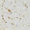 Immunohistochemistry of paraffin-embedded mouse brain using COQ3 antibody (22-962) at dilution of 1:100 (40x lens) .