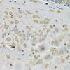 Immunohistochemistry of paraffin-embedded rat brain using SAR1A Antibody (22-968) at dilution of 1:100 (40x lens) .