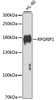 Western blot analysis of extracts of HL-60 cells, using RPGRIP1 antibody (22-969) at 1:1000 dilution.<br/>Secondary antibody: HRP Goat Anti-Rabbit IgG (H+L) at 1:10000 dilution.<br/>Lysates/proteins: 25ug per lane.<br/>Blocking buffer: 3% nonfat dry milk in TBST.<br/>Detection: ECL Enhanced Kit.<br/>Exposure time: 30s.