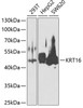 Western blot analysis of extracts of various cell lines, using KRT16 antibody (22-981) at 1:1000 dilution.<br/>Secondary antibody: HRP Goat Anti-Rabbit IgG (H+L) at 1:10000 dilution.<br/>Lysates/proteins: 25ug per lane.<br/>Blocking buffer: 3% nonfat dry milk in TBST.<br/>Detection: ECL Basic Kit.<br/>Exposure time: 60s.