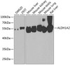 Western blot analysis of extracts of various cell lines, using ALDH1A2 antibody (22-990) at 1:1000 dilution.<br/>Secondary antibody: HRP Goat Anti-Rabbit IgG (H+L) at 1:10000 dilution.<br/>Lysates/proteins: 25ug per lane.<br/>Blocking buffer: 3% nonfat dry milk in TBST.<br/>Detection: ECL Basic Kit.<br/>Exposure time: 90s.