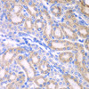 Immunohistochemistry of paraffin-embedded rat kidney using ALDH1A2 antibody (22-990) at dilution of 1:100 (40x lens) .