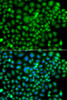 Immunofluorescence analysis of A549 cells using SUMO4 antibody (22-999) . Blue: DAPI for nuclear staining.