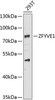 Western blot analysis of extracts of 293T cells, using ZFYVE1 antibody (23-006) at 1:1000 dilution.<br/>Secondary antibody: HRP Goat Anti-Rabbit IgG (H+L) at 1:10000 dilution.<br/>Lysates/proteins: 25ug per lane.<br/>Blocking buffer: 3% nonfat dry milk in TBST.<br/>Detection: ECL Basic Kit.<br/>Exposure time: 90s.