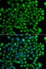 Immunofluorescence analysis of A549 cells using ZFYVE1 antibody (23-006) . Blue: DAPI for nuclear staining.