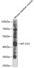 Western blot analysis of extracts of mouse skeletal muscle, using MT-CO1 antibody (23-008) at 1:1000 dilution.<br/>Secondary antibody: HRP Goat Anti-Rabbit IgG (H+L) at 1:10000 dilution.<br/>Lysates/proteins: 25ug per lane.<br/>Blocking buffer: 3% nonfat dry milk in TBST.<br/>Detection: ECL Basic Kit.<br/>Exposure time: 10s.