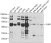 Western blot analysis of extracts of various cell lines, using CHN1 antibody (23-019) at 1:1000 dilution.<br/>Secondary antibody: HRP Goat Anti-Rabbit IgG (H+L) at 1:10000 dilution.<br/>Lysates/proteins: 25ug per lane.<br/>Blocking buffer: 3% nonfat dry milk in TBST.<br/>Detection: ECL Basic Kit.<br/>Exposure time: 5s.