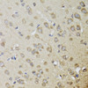 Immunohistochemistry of paraffin-embedded rat brain using CHN1 antibody (23-019) at dilution of 1:100 (40x lens) .