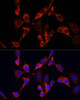 Immunofluorescence analysis of NIH/3T3 cells using DVL2 antibody (23-022) at dilution of 1:100. Blue: DAPI for nuclear staining.