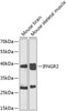 Western blot analysis of extracts of various cell lines, using IFNGR2 antibody (23-026) at 1:1000 dilution._Secondary antibody: HRP Goat Anti-Rabbit IgG (H+L) at 1:10000 dilution._Lysates/proteins: 25ug per lane._Blocking buffer: 3% nonfat dry milk in TBST._Detection: ECL Enhanced Kit._Exposure time: 30s.