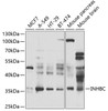 Western blot analysis of extracts of various cell lines, using INHBC antibody (23-027) at 1:1000 dilution._Secondary antibody: HRP Goat Anti-Rabbit IgG (H+L) at 1:10000 dilution._Lysates/proteins: 25ug per lane._Blocking buffer: 3% nonfat dry milk in TBST._Detection: ECL Enhanced Kit._Exposure time: 90s.