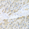 Immunohistochemistry of paraffin-embedded human liver using CCL3 antibody (23-032) at dilution of 1:100 (40x lens) .