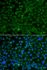 Immunofluorescence analysis of A549 cells using WDR45 antibody (23-041) . Blue: DAPI for nuclear staining.