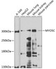 Western blot analysis of extracts of various cell lines, using MYO5C antibody (23-048) at 1:1000 dilution.<br/>Secondary antibody: HRP Goat Anti-Rabbit IgG (H+L) at 1:10000 dilution.<br/>Lysates/proteins: 25ug per lane.<br/>Blocking buffer: 3% nonfat dry milk in TBST.<br/>Detection: ECL Basic Kit.<br/>Exposure time: 90s.