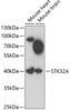 Western blot analysis of extracts of various cell lines, using STK32A antibody (23-055) at 1:1000 dilution.<br/>Secondary antibody: HRP Goat Anti-Rabbit IgG (H+L) at 1:10000 dilution.<br/>Lysates/proteins: 25ug per lane.<br/>Blocking buffer: 3% nonfat dry milk in TBST.<br/>Detection: ECL Enhanced Kit.<br/>Exposure time: 90s.