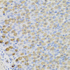 Immunohistochemistry of paraffin-embedded mouse stomach using LDHB antibody (23-061) at dilution of 1:100 (40x lens) .