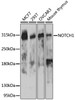 Western blot analysis of extracts of various cell lines, using NOTCH1 antibody (23-069) at 1:1000 dilution.<br/>Secondary antibody: HRP Goat Anti-Rabbit IgG (H+L) at 1:10000 dilution.<br/>Lysates/proteins: 25ug per lane.<br/>Blocking buffer: 3% nonfat dry milk in TBST.<br/>Detection: ECL Enhanced Kit.<br/>Exposure time: 90s.
