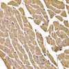 Immunohistochemistry of paraffin-embedded mouse heart using GLUT4 antibody (23-070) at dilution of 1:100 (40x lens) .