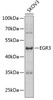 Western blot analysis of extracts of SKOV3 cells, using EGR3 antibody (23-093) at 1:1000 dilution.<br/>Secondary antibody: HRP Goat Anti-Rabbit IgG (H+L) at 1:10000 dilution.<br/>Lysates/proteins: 25ug per lane.<br/>Blocking buffer: 3% nonfat dry milk in TBST.<br/>Detection: ECL Enhanced Kit.<br/>Exposure time: 30s.