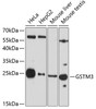 Western blot analysis of extracts of various cell lines, using GSTM3 antibody (23-103) at 1:3000 dilution.<br/>Secondary antibody: HRP Goat Anti-Rabbit IgG (H+L) at 1:10000 dilution.<br/>Lysates/proteins: 25ug per lane.<br/>Blocking buffer: 3% nonfat dry milk in TBST.<br/>Detection: ECL Basic Kit.<br/>Exposure time: 90s.
