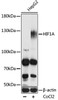 Western blot analysis of extracts of HepG2 cells, using HIF1A antibody (23-105) at 1:1000 dilution.HepG2 cells were treated by Cobalt chloride (0.1 mM) at 37℃ for 4 hours.<br/>Secondary antibody: HRP Goat Anti-Rabbit IgG (H+L) at 1:10000 dilution.<br/>Lysates/proteins: 25ug per lane.<br/>Blocking buffer: 3% nonfat dry milk in TBST.<br/>Detection: ECL Basic Kit.<br/>Exposure time: 15s.