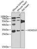 Western blot analysis of extracts of various cell lines, using HOXD10 antibody (23-106) at 1:1000 dilution.<br/>Secondary antibody: HRP Goat Anti-Rabbit IgG (H+L) at 1:10000 dilution.<br/>Lysates/proteins: 25ug per lane.<br/>Blocking buffer: 3% nonfat dry milk in TBST.<br/>Detection: ECL Basic Kit.<br/>Exposure time: 90s.