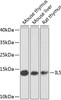 Western blot analysis of extracts of various cell lines, using IL5 antibody (23-110) at 1:1000 dilution._Secondary antibody: HRP Goat Anti-Rabbit IgG (H+L) at 1:10000 dilution._Lysates/proteins: 25ug per lane._Blocking buffer: 3% nonfat dry milk in TBST._Detection: ECL Enhanced Kit._Exposure time: 15s.