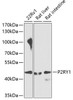 Western blot analysis of extracts of various cell lines, using P2RY1 antibody (23-120) at 1:1000 dilution._Secondary antibody: HRP Goat Anti-Rabbit IgG (H+L) at 1:10000 dilution._Lysates/proteins: 25ug per lane._Blocking buffer: 3% nonfat dry milk in TBST._Detection: ECL Enhanced Kit._Exposure time: 90s.