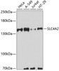 Western blot analysis of extracts of various cell lines, using SLC4A2 antibody (23-137) at 1:3000 dilution.<br/>Secondary antibody: HRP Goat Anti-Rabbit IgG (H+L) at 1:10000 dilution.<br/>Lysates/proteins: 25ug per lane.<br/>Blocking buffer: 3% nonfat dry milk in TBST.<br/>Detection: ECL Basic Kit.<br/>Exposure time: 30s.