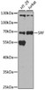Western blot analysis of extracts of various cell lines, using SRF antibody (23-139) at 1:500 dilution.<br/>Secondary antibody: HRP Goat Anti-Rabbit IgG (H+L) at 1:10000 dilution.<br/>Lysates/proteins: 25ug per lane.<br/>Blocking buffer: 3% nonfat dry milk in TBST.<br/>Detection: ECL Basic Kit.<br/>Exposure time: 90s.
