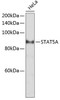 Western blot analysis of extracts of HeLa cells, using STAT5A antibody (23-141) at 1:2000 dilution.<br/>Secondary antibody: HRP Goat Anti-Rabbit IgG (H+L) at 1:10000 dilution.<br/>Lysates/proteins: 25ug per lane.<br/>Blocking buffer: 3% nonfat dry milk in TBST.<br/>Detection: ECL Basic Kit.<br/>Exposure time: 10s.