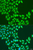 Immunofluorescence analysis of U2OS cells using STAT5A antibody (23-141) at dilution of 1:100. Blue: DAPI for nuclear staining.