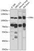 Western blot analysis of extracts of various cell lines, using STRN antibody (23-142) at 1:1000 dilution.<br/>Secondary antibody: HRP Goat Anti-Rabbit IgG (H+L) at 1:10000 dilution.<br/>Lysates/proteins: 25ug per lane.<br/>Blocking buffer: 3% nonfat dry milk in TBST.<br/>Detection: ECL Enhanced Kit.<br/>Exposure time: 30s.