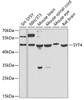 Western blot analysis of extracts of various cell lines, using SYT4 antibody (23-145) at 1:1000 dilution.<br/>Secondary antibody: HRP Goat Anti-Rabbit IgG (H+L) at 1:10000 dilution.<br/>Lysates/proteins: 25ug per lane.<br/>Blocking buffer: 3% nonfat dry milk in TBST.<br/>Detection: ECL Basic Kit.<br/>Exposure time: 90s.