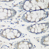 Immunohistochemistry of paraffin-embedded human colon using TNNC2 antibody (23-146) at dilution of 1:200 (40x lens) .