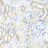 Immunohistochemistry of paraffin-embedded rat kidney using BSND antibody (23-152) at dilution of 1:100 (40x lens) .