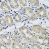 Immunohistochemistry of paraffin-embedded human stomach using ST8SIA2 antibody (23-153) at dilution of 1:100 (40x lens) .
